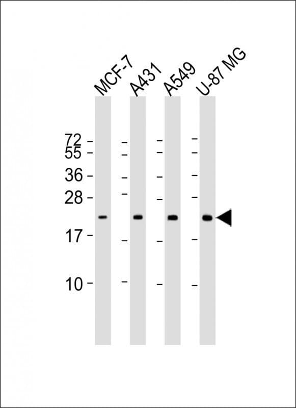 RAB13 Antibody (aa1-203, clone 1600CT845.37.29)