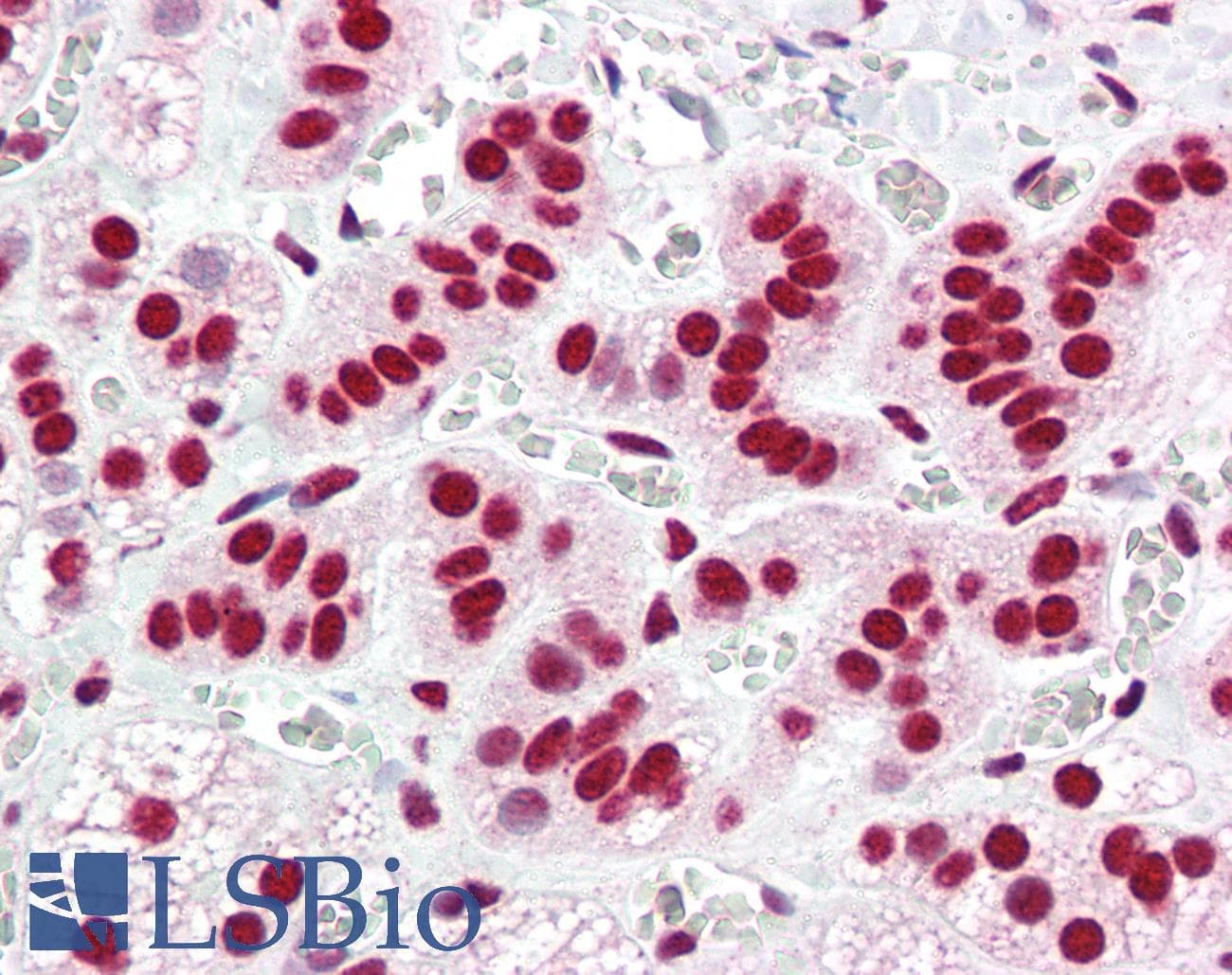 PathPlus™ Polyclonal Rabbit anti-Human ACIN1 / Acinus Antibody (IHC, IF, WB)