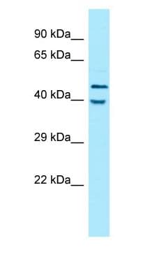 KIR2DL5A / KIR2DL5 Antibody (aa300-349)