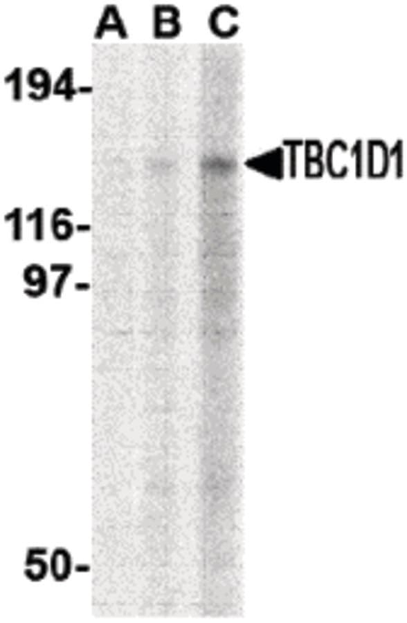 IHC-plus™ TBC1 / TBC1D1 Antibody
