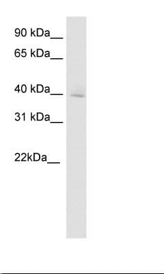 Polyclonal Rabbit anti-Mouse DMBX1 / OTX3 Antibody (aa176-225, IHC, WB)