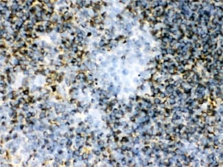 TGM2 / Transglutaminase 2 Antibody