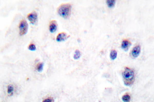 GABRB1 Antibody (Arg328)