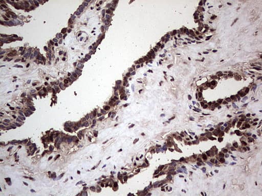 Monoclonal Mouse anti-Human SAE1 Antibody (clone OTI6B11, Carrier-free, IHC, WB)
