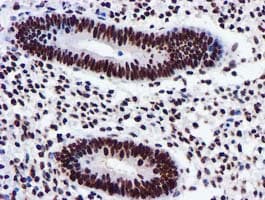 GSTT2 Antibody (clone OTI3B6)