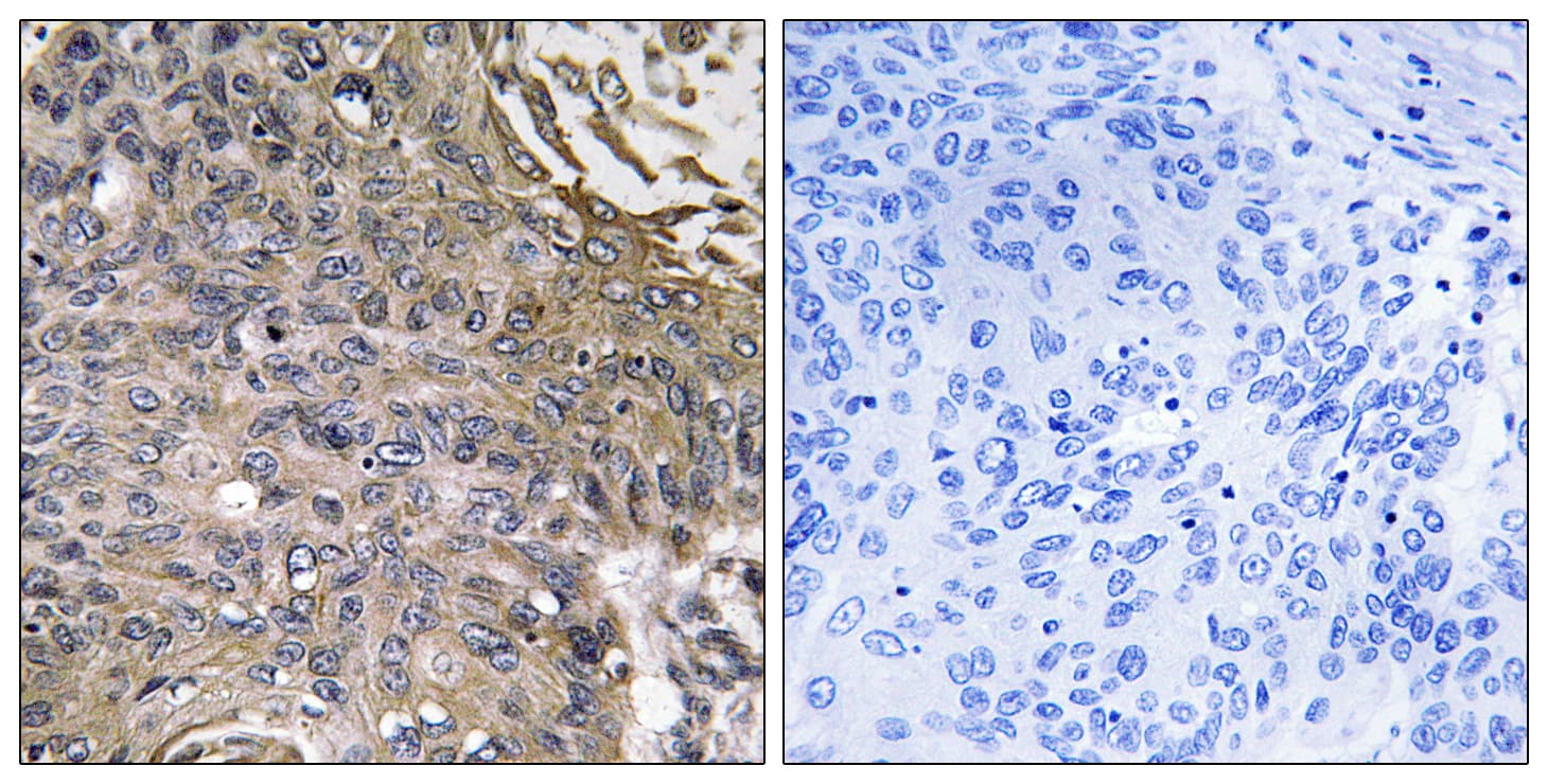 EAT2 / SH2D1B Antibody (aa71-120)