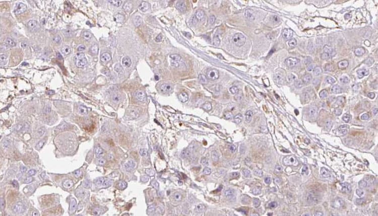 OR1E2 Antibody