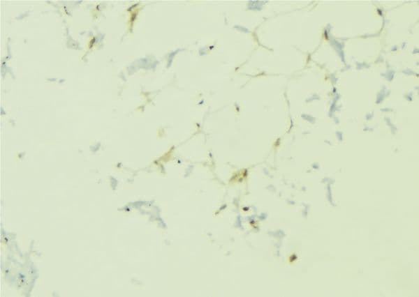 ADIPOR1/Adiponectin Receptor 1 Antibody