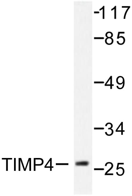 Polyclonal Rabbit anti-Human TIMP4 Antibody (Ser206, IHC, WB)