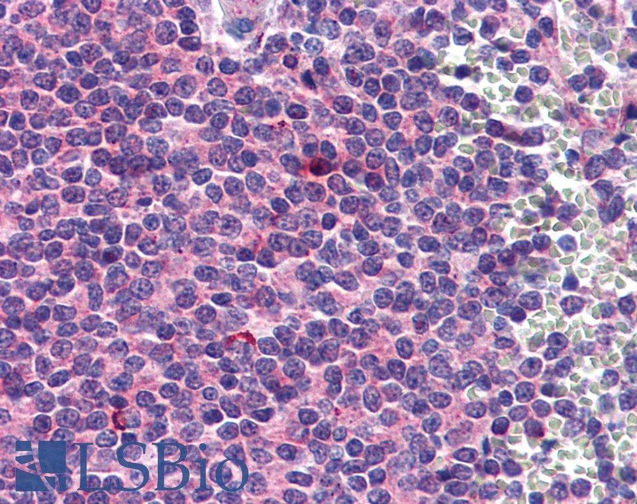 IHC-plus™ SEPT6 / Septin 6 Antibody (clone 1D6)