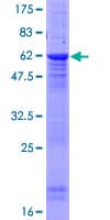Human PPP2R2D Protein (Recombinant GST)