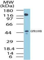 IHC-plus™ HCAR3 / GPR109B / HM74 Antibody (aa1-50)