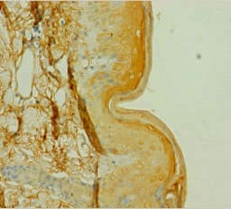 CSNK1A1 / CK1 Alpha Antibody