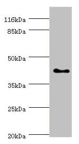 SH3GL2 Antibody