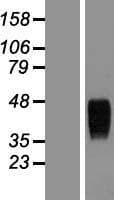ANTXR1 / TEM8 Protein (Over-Expression Lysate Myc-DDK (Flag))