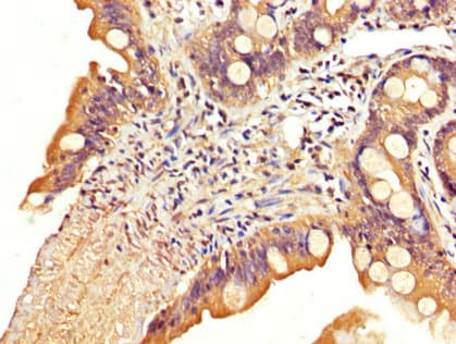 Polyclonal Rabbit anti-Human SLC22A23 Antibody (IHC, WB)