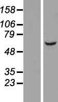 LRRC31 Protein (Over-Expression Lysate Myc-DDK (Flag))