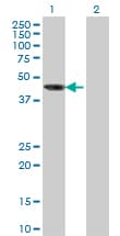 AIPL1 Antibody (clone 1E1)