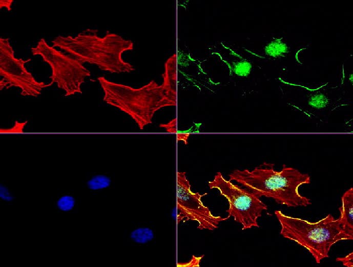 MGMT Antibody (clone UMAB52, Carrier-free)