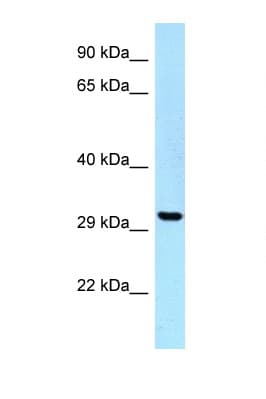 UBE2Z / USE1 Antibody (C-Terminus)