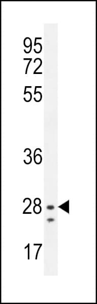Polyclonal Rabbit anti-Human NIPSNAP3B Antibody (aa189-218, IHC, WB)