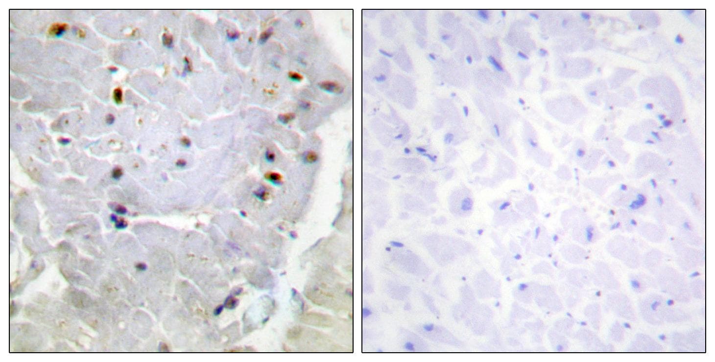 Polyclonal Rabbit anti-Human PINX1 Antibody (IHC)