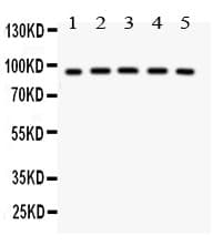 NR3C1/Glucocorticoid Receptor Antibody (aa1-373)