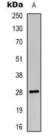 Polyclonal Rabbit anti-Human HLA-DOA Antibody (Internal, WB)
