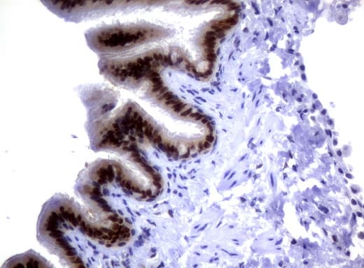 Monoclonal Mouse anti-Human MGMT Antibody (clone UMAB52, IHC, IF, WB)