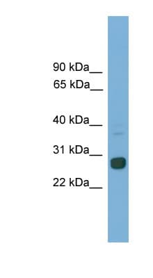 MXD1 / MAD1 Antibody (aa681-730)