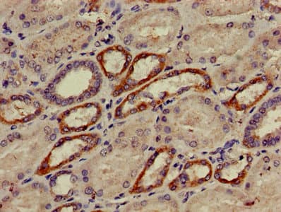 AP50 / AP2M1 Antibody