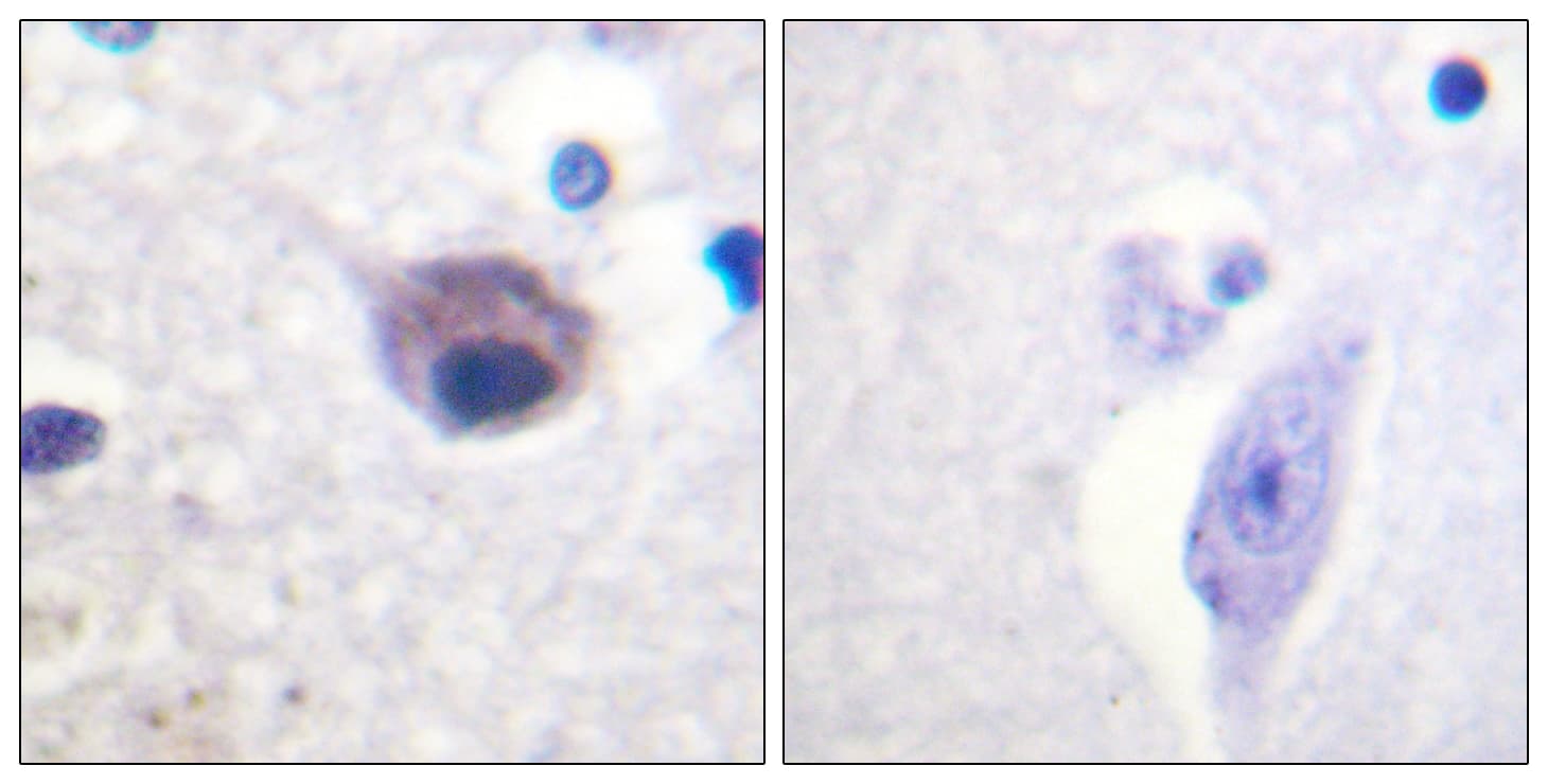 Polyclonal Rabbit anti-Human VAV2 Antibody (phospho-Tyr142, IHC, IF, WB)