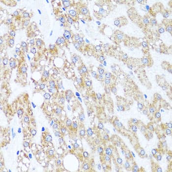 Polyclonal Rabbit anti-Human CHD1 Antibody (IHC, WB)