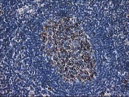 DLD / Diaphorase / E3 Antibody (clone OTI6D5)