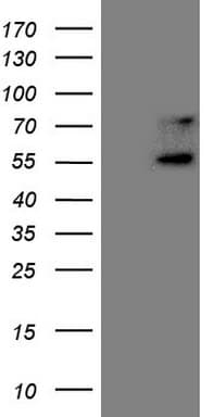 UBP1 Antibody (aa47-269, clone OTI6C7)