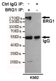 SMARCA4 / BRG1 Antibody