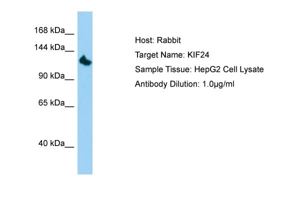 Polyclonal Rabbit anti-Human KIF24 Antibody (aa207-256, WB)
