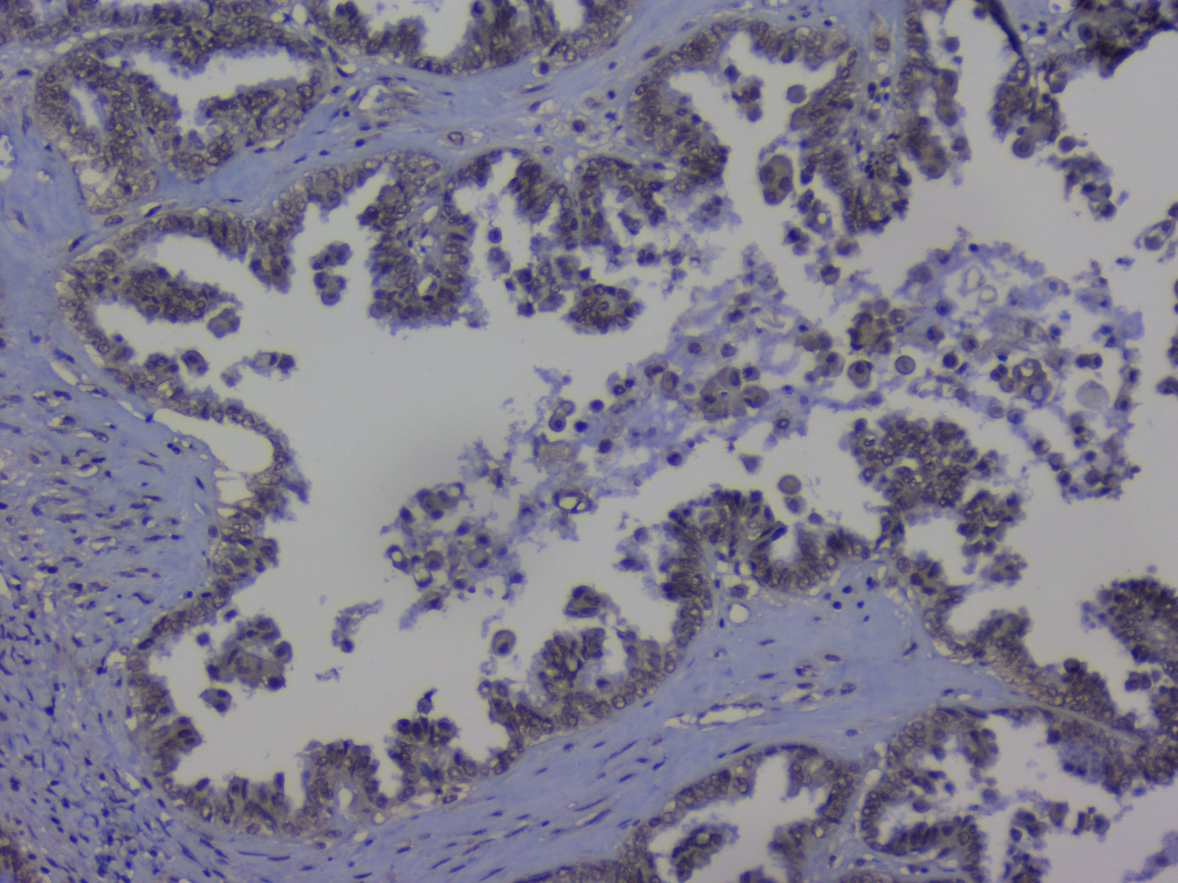 NRF1 / NRF-1 Antibody