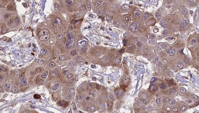 GRM4 / MGLUR4 Antibody