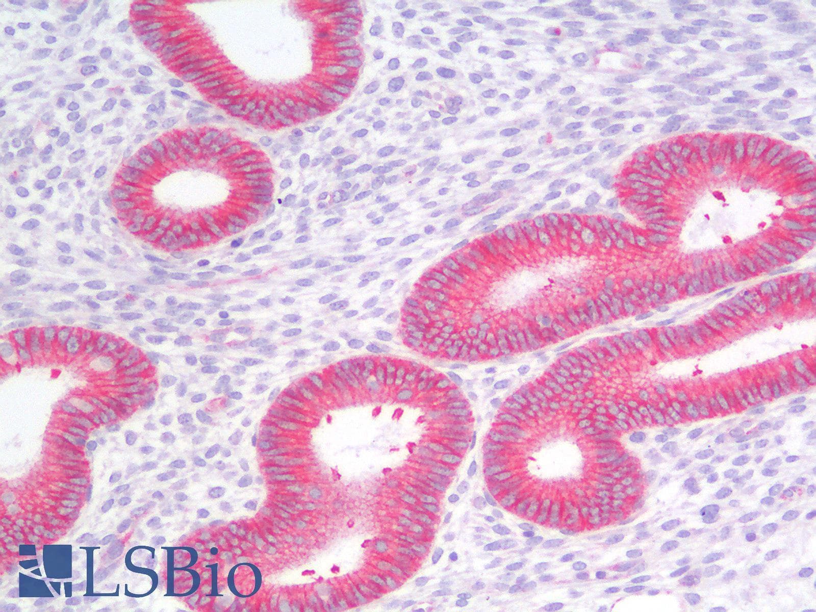 PathPlus™ Polyclonal Rabbit anti-Human CDH1 / E Cadherin Antibody (IHC)