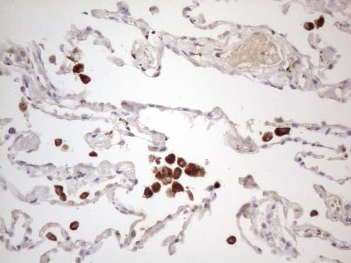 CSF2RB / CD131 Antibody (clone OTI1G5)