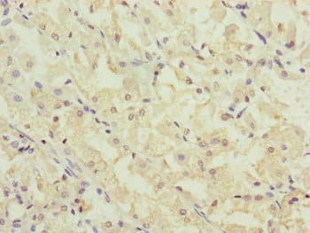 Polyclonal Rabbit anti-Human CEP44 / KIAA1712 Antibody (IHC, WB)