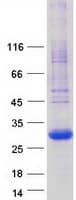 Human PGRMC1 / MPR Protein (Recombinant Myc-DDK (Flag))