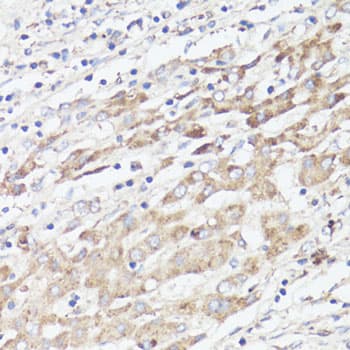 Polyclonal Rabbit anti-Human IGFBP1 Antibody (IHC, WB)