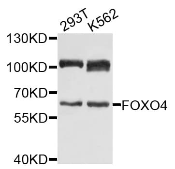 FOXO4 / AFX1 Antibody