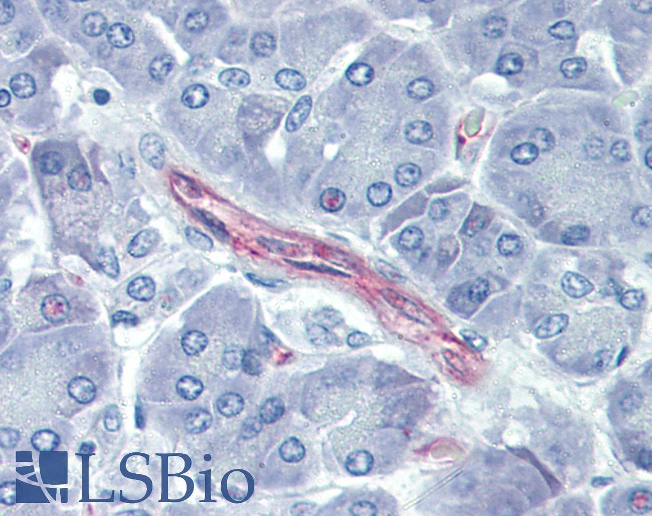 IHC-plus™ CD144 / CDH5 / VE Cadherin Antibody (clone 16B1)