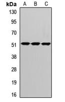 IHC-plus™ Polyclonal Rabbit anti-Human CRBN / Cereblon Antibody (IHC, WB)