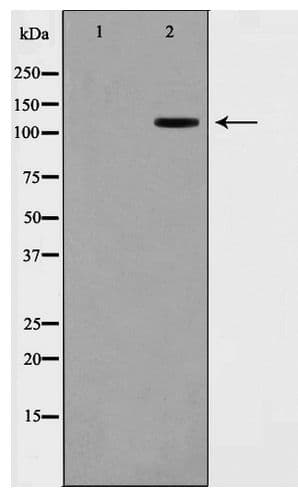 XRN2 Antibody