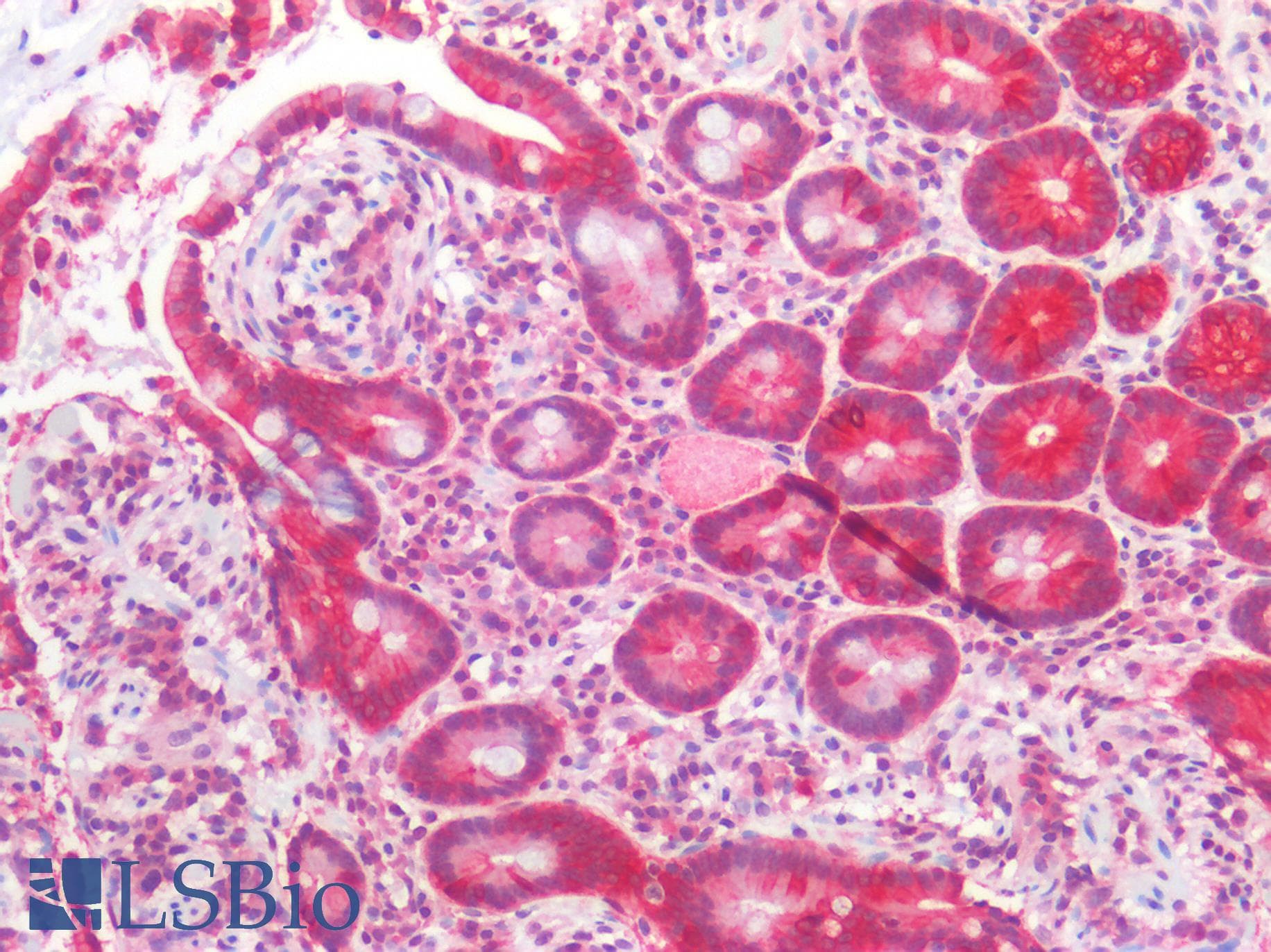 PathPlus™ CLDN4 / Claudin 4 Antibody (C-Terminus)