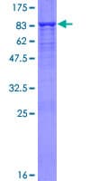 Human CYB5R4 Protein (Recombinant GST)